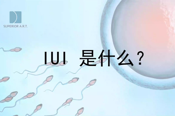 燕威娜医生讲解,IUI(宫腔内人工授精)是什么？